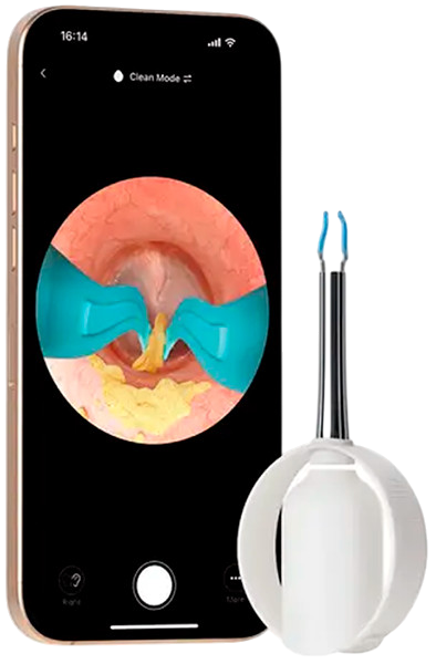 Умная ушная палочка Xiaomi Bebird Visual Ear Picking Device Bebird 3 Plus, Pink (розовая)